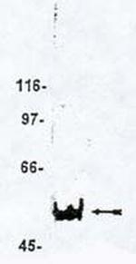 MAGI3 Polyclonal Antibody