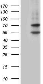 MAK Antibody in Western Blot (WB)
