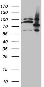 MAK Antibody in Western Blot (WB)