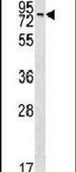 MAK Antibody in Western Blot (WB)