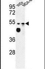 MARVELD2 Antibody in Western Blot (WB)