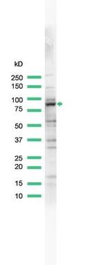 MALT1 Antibody in Western Blot (WB)