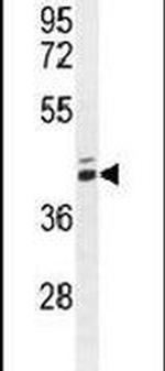 MAMSTR Antibody in Western Blot (WB)