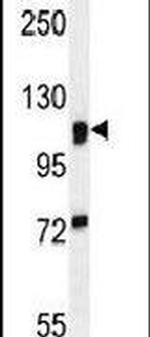 MAN2A1 Antibody in Western Blot (WB)