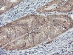 MAOA Antibody in Immunohistochemistry (Paraffin) (IHC (P))