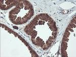 MAOA Antibody in Immunohistochemistry (Paraffin) (IHC (P))