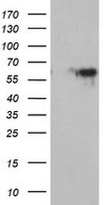 MAOA Antibody in Western Blot (WB)