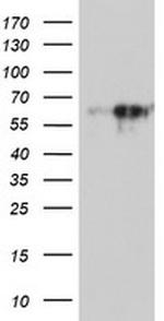 MAOA Antibody in Western Blot (WB)