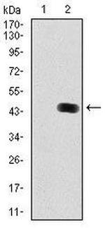 LC3B Monoclonal Antibody (5H12)