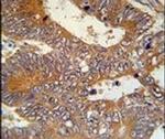 MAP1S Antibody in Immunohistochemistry (IHC)