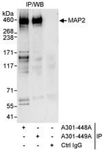 MAP2 Antibody in Immunoprecipitation (IP)