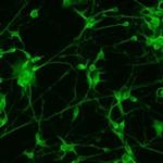MAP2 Antibody in Immunocytochemistry (ICC/IF)