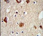 MAP2 Antibody in Immunohistochemistry (IHC)