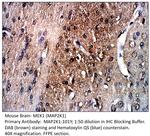 MAP2K1 Antibody in Immunohistochemistry (IHC)