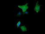 MAP2K1 Antibody in Immunocytochemistry (ICC/IF)
