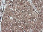 MAP2K1 Antibody in Immunohistochemistry (Paraffin) (IHC (P))