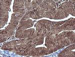 MAP2K1 Antibody in Immunohistochemistry (Paraffin) (IHC (P))