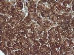 MAP2K1 Antibody in Immunohistochemistry (Paraffin) (IHC (P))