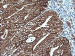 MAP2K1 Antibody in Immunohistochemistry (Paraffin) (IHC (P))