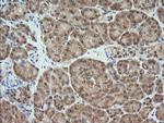 MAP2K1 Antibody in Immunohistochemistry (Paraffin) (IHC (P))