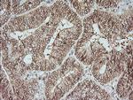 MAP2K1 Antibody in Immunohistochemistry (Paraffin) (IHC (P))