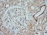 MAP2K1 Antibody in Immunohistochemistry (Paraffin) (IHC (P))