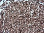 MAP2K1 Antibody in Immunohistochemistry (Paraffin) (IHC (P))