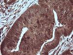 MAP2K1 Antibody in Immunohistochemistry (Paraffin) (IHC (P))