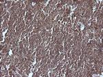 MAP2K1 Antibody in Immunohistochemistry (Paraffin) (IHC (P))