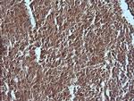 MAP2K1 Antibody in Immunohistochemistry (Paraffin) (IHC (P))