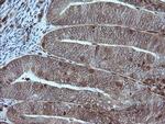 MAP2K1 Antibody in Immunohistochemistry (Paraffin) (IHC (P))