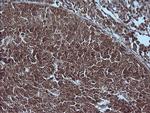 MAP2K1 Antibody in Immunohistochemistry (Paraffin) (IHC (P))
