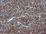 MAP2K1 Antibody in Immunohistochemistry (Paraffin) (IHC (P))