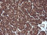 MAP2K1 Antibody in Immunohistochemistry (Paraffin) (IHC (P))