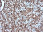 MAP2K1 Antibody in Immunohistochemistry (Paraffin) (IHC (P))
