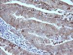 MAP2K1 Antibody in Immunohistochemistry (Paraffin) (IHC (P))