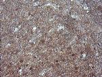 MAP2K1 Antibody in Immunohistochemistry (Paraffin) (IHC (P))
