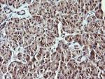 MAP2K1 Antibody in Immunohistochemistry (Paraffin) (IHC (P))