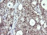MAP2K1 Antibody in Immunohistochemistry (Paraffin) (IHC (P))