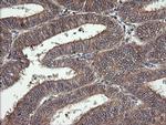 MAP2K1 Antibody in Immunohistochemistry (Paraffin) (IHC (P))