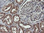 MAP2K1 Antibody in Immunohistochemistry (Paraffin) (IHC (P))