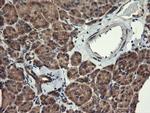 MAP2K1 Antibody in Immunohistochemistry (Paraffin) (IHC (P))