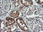 MAP2K1 Antibody in Immunohistochemistry (Paraffin) (IHC (P))