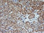MAP2K1 Antibody in Immunohistochemistry (Paraffin) (IHC (P))