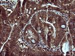 MAP2K1 Antibody in Immunohistochemistry (Paraffin) (IHC (P))