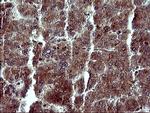 MAP2K1 Antibody in Immunohistochemistry (Paraffin) (IHC (P))