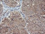 MAP2K1 Antibody in Immunohistochemistry (Paraffin) (IHC (P))