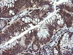 MAP2K1 Antibody in Immunohistochemistry (Paraffin) (IHC (P))