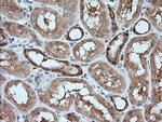 MAP2K1 Antibody in Immunohistochemistry (Paraffin) (IHC (P))