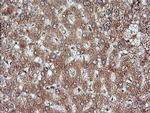 MAP2K1 Antibody in Immunohistochemistry (Paraffin) (IHC (P))